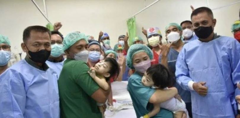RSUP Prof Kandou Manado Berhasil Operasi Anak TNI si Kembar Joana dan Jofelin 2 05
